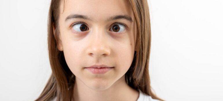 Squint Surgery: What to Expect, Benefits, and Recovery