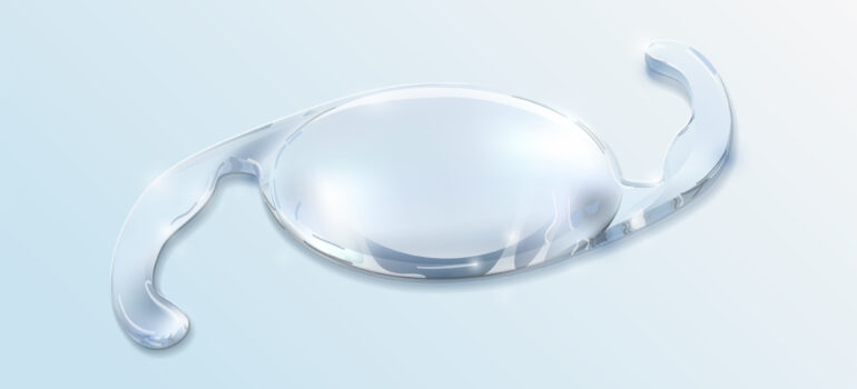 Types of IOLs: A Complete Guide to Intraocular Lenses